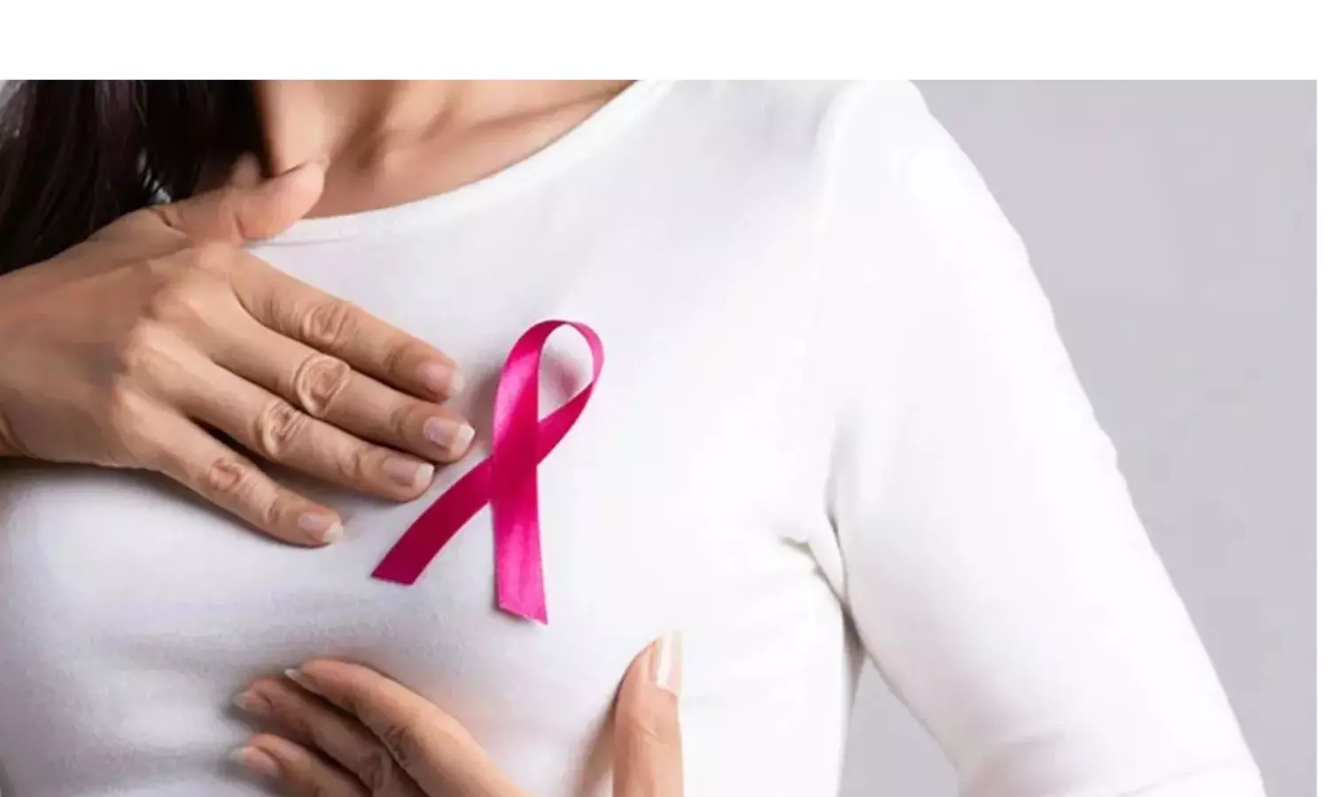 BreastCancer