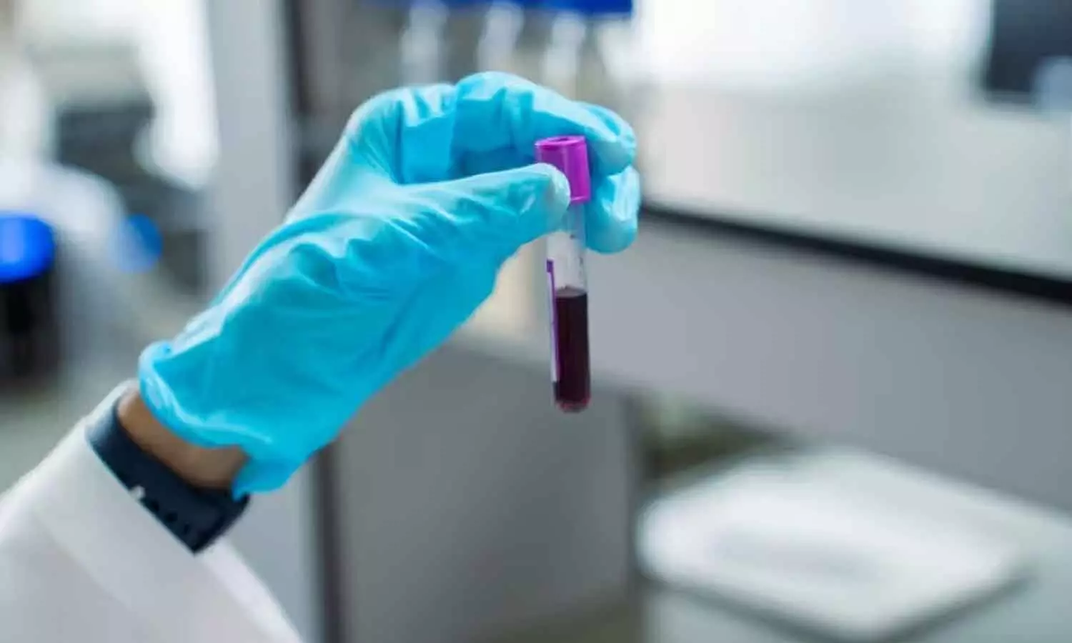 Blood test may help detect pancreatic cancer in earliest stages: Researchers Blood test may help detect pancreatic cancer in earliest stages: Researchers