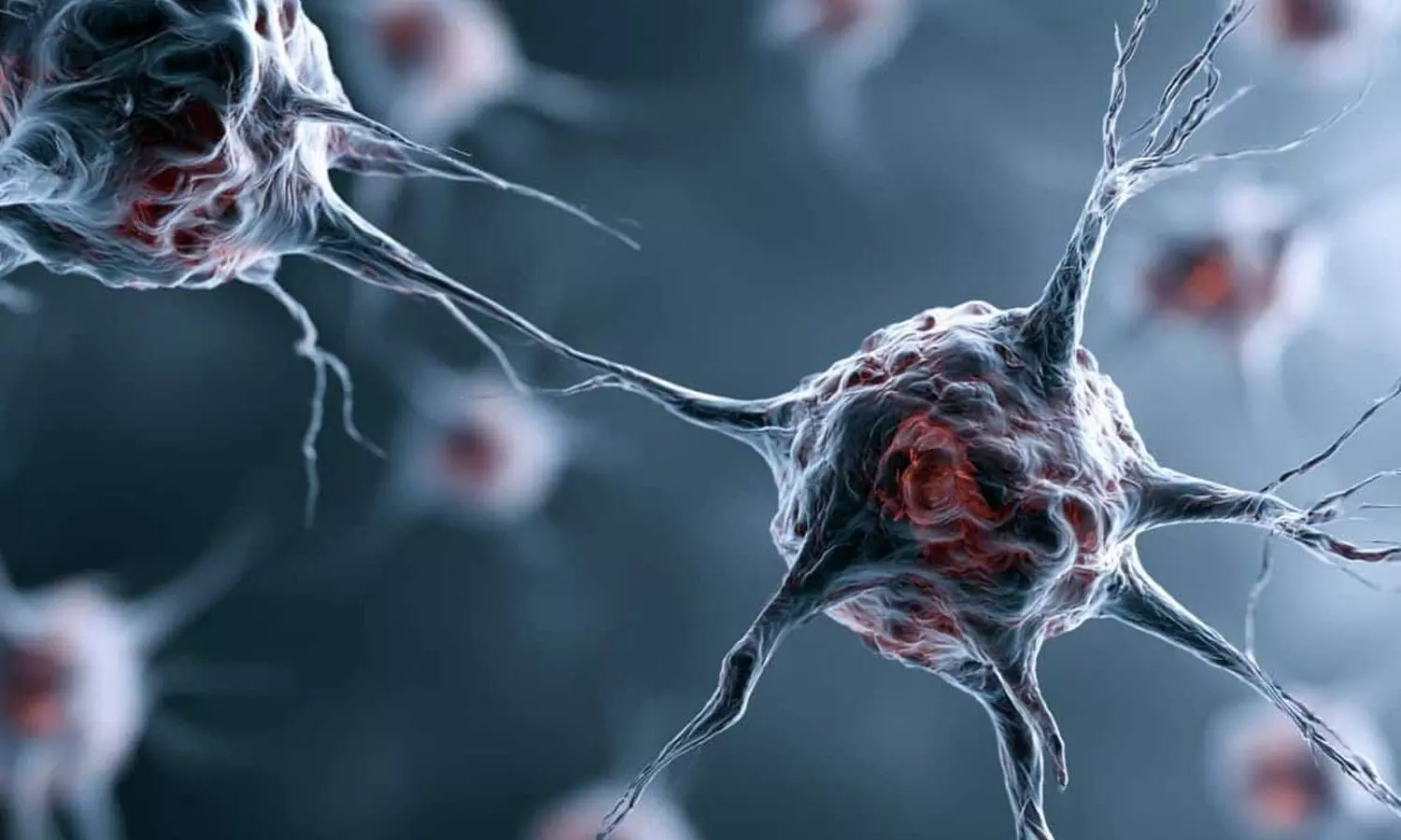 Viral infection may pave way for Parkinsons: CCMB Viral infection may pave way for Parkinsons: CCMB